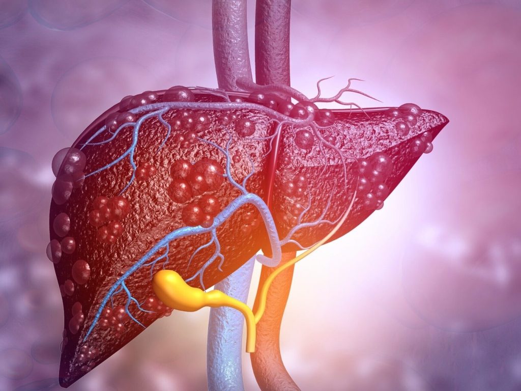 Hepatic encephalopathy - types, causes, symptoms and treatment