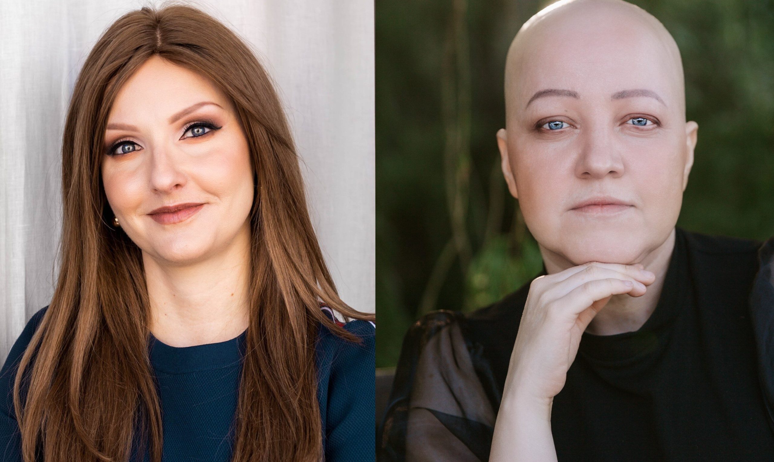 Who are the alopecia women?  Agata: "My husband has never seen me without a wig."  Marta: “There was a time when I took my hair off.  Maybe I wanted to scream my alopecia?”
