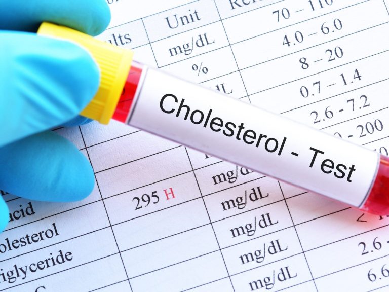 Can Good Cholesterol Contribute to Dementia?  The scientists’ findings are surprising